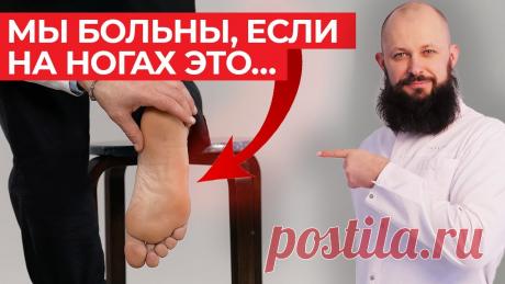 Как определить состояние здоровья по стопам человека? / Методы лечения ног ❤️ Бесплатный тренинг «Здоровое Сердце» - https://mamatov.club/regheart3?utm_source=youtube&utm_medium=video&utm_campaign=heart&utm_content=ccaBmeLKYYc&utm_t...