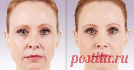 Упражнение «Ластик»: удаляем носогубные «скорбные» складки