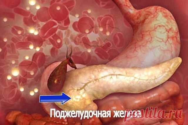 ЕСЛИ ВАША ПОДЖЕЛУДОЧНАЯ СТРАДАЕТ - РЕЦЕПТ С МГНОВЕННЫМ ДЕЙСТВИЕМ.
