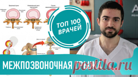 Грыжа пройдет сама? Межпозвоночная грыжа - симптомы и лечение. Резорбция грыжи | ТОП 100 ВРАЧЕЙ | Дзен