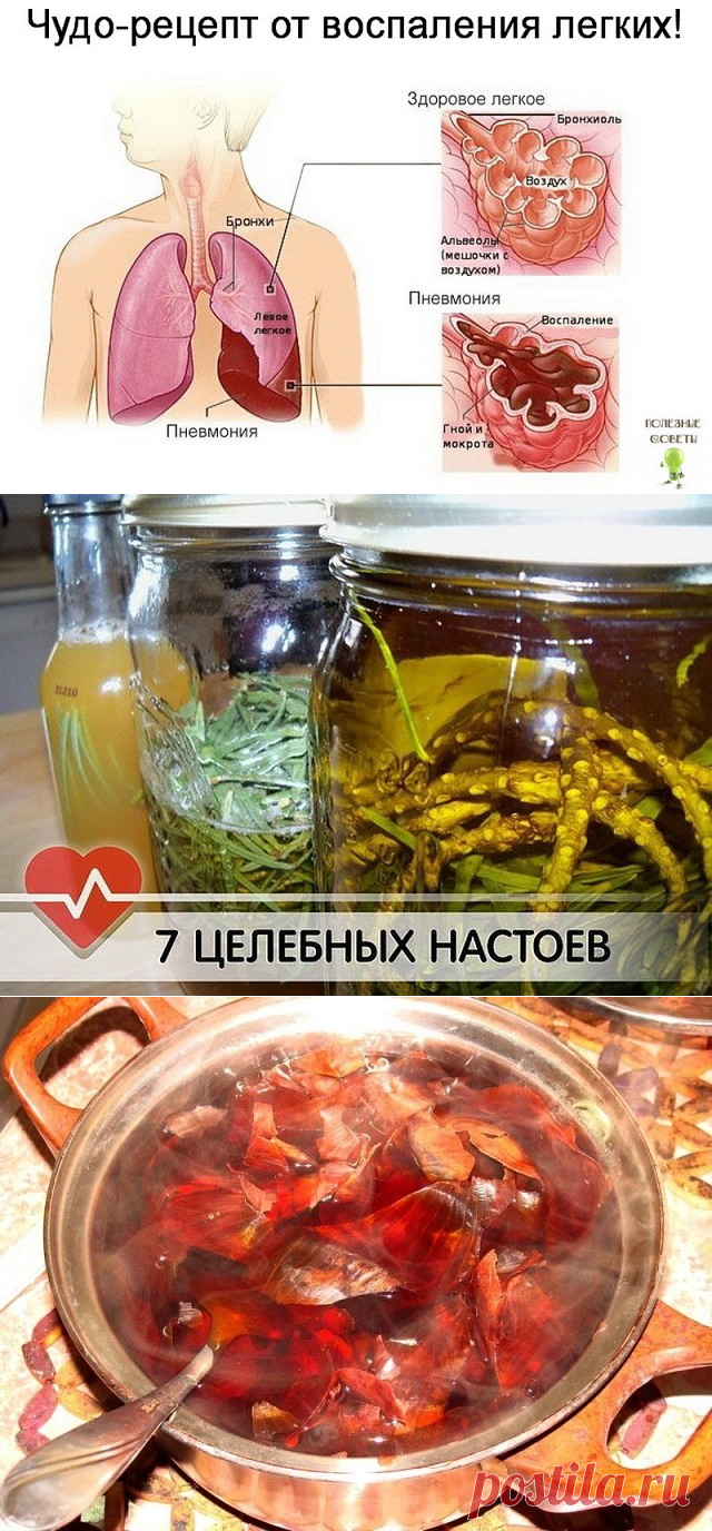 (1) Одноклассники