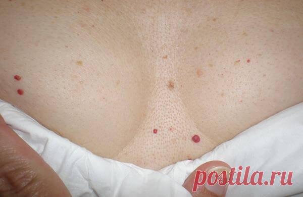 Есть ли у вас красные пятна на разных частях вашего тела? Стоит ли из-за них волноваться? Что нужно делать? » MAKATAKA