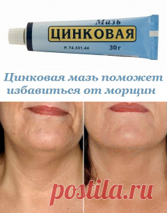 Цинковая мазь от морщин – в косметологии, под глазами, инструкция по применению