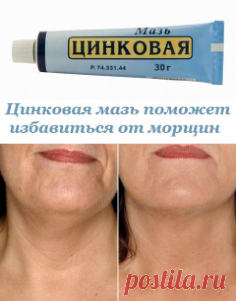 Цинковая мазь от морщин – в косметологии, под глазами, инструкция по применению