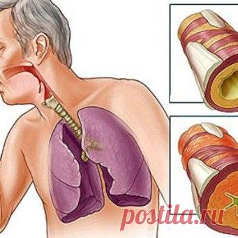 Простые способы удаления слизи и мокроты
