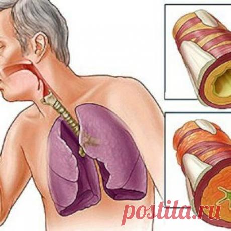 Простые способы удаления слизи и мокроты