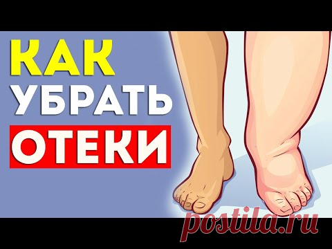 Как убрать ОТЁКИ на ногах? Как убрать отёки на лице? Как убрать мешки под глазами?