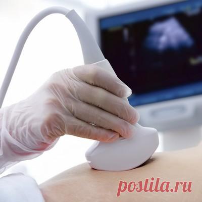 УЗИ-диагностика сактосальпинкса
