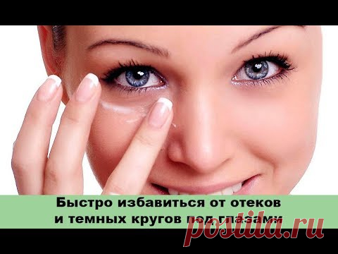 Отеки и темные круги под глазами - как быстро избавиться в домашних условиях?