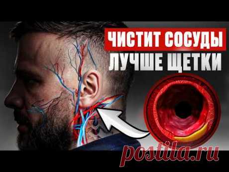 Как очистить сосуды от бляшек и тромбов за 5 простых шагов