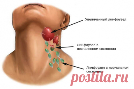 ОЧИЩЕНИЕ ЛИМФАТИЧЕСКИХ УЗЛОВ И ПРОТОКОВ

#ВЪДИ #Исторiя #Человъкъ #Образованiе #Питаніе #Народъ #Книгi

Очистка лимфатической системы - обязательный шаг на пути к здоровью. Это возможность избежать многих болезней и очистить организм.

Очищение лимфатической системы 
Очищать лимфатическую систему так же важно, как и другие органы и системы нашего организма.

Лимфатическая система включает в себя:

- лимфатические узлы,
- сосуды,
- капилляры,
- межклеточную жидкость.

Лимфа...