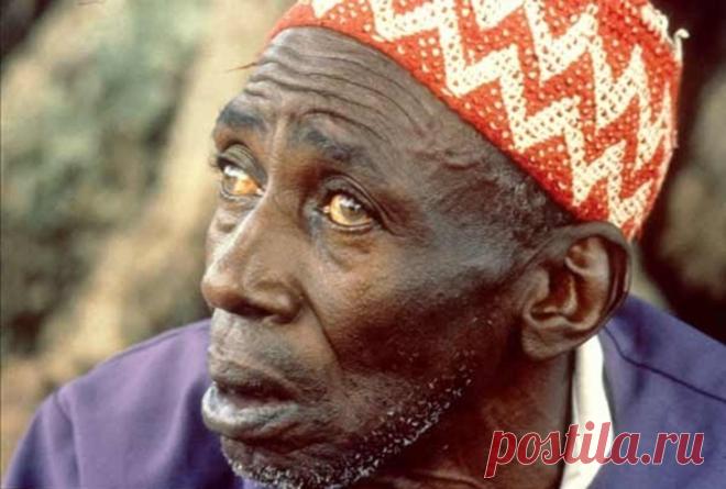 10 самых страшных паразитов, которые могут жить в человеческом теле