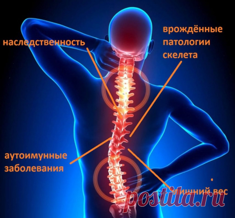Простое средство от остеохондроза и гипертонии! Забудьте о боли в суставах!