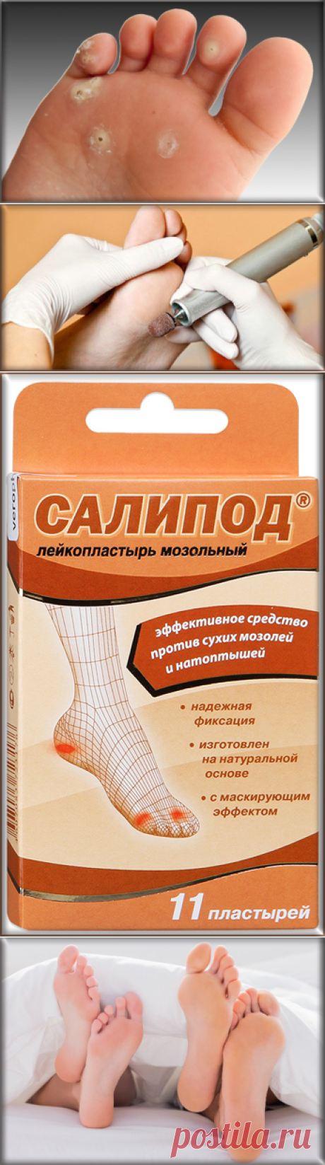 Как избавиться от стержневой мозоли?