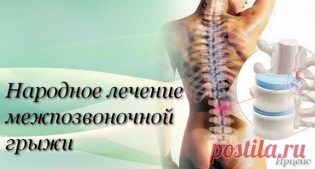 Народное лечение межпозвонковой грыжи.А.Маматов