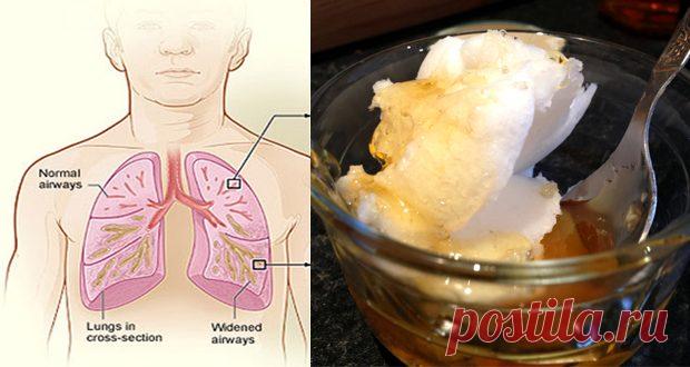 Простые домашние средства от простуды / Будьте здоровы