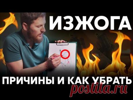 ИЗЖОГА - Причины и средство от изжоги