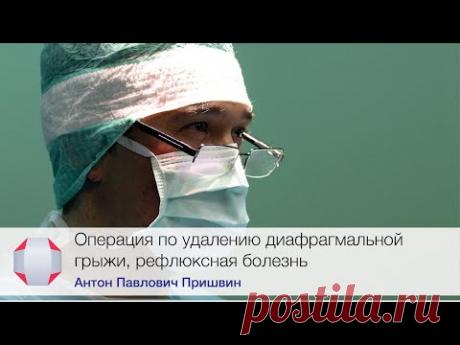 Операция по удалению диафрагмальной грыжи, рефлюксная болезнь. Врач-хирург, Пришвин А.П.