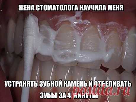 Если тебе не терпится блеснуть обезоруживающей улыбкой, но средств на стоматолога нет, то эти домашние средства для тебя. ЖЕНА СТОМАТОЛОГА НАУЧИЛА МЕНЯ УСТРАНЯТЬ ЗУБНОЙ КАМЕНЬ И ОТБЕЛИВАТЬ ЗУБЫ ЗА 4 МИНУТЫ Голливуд задал моду на белоснежную улыбку, которая считается признаком