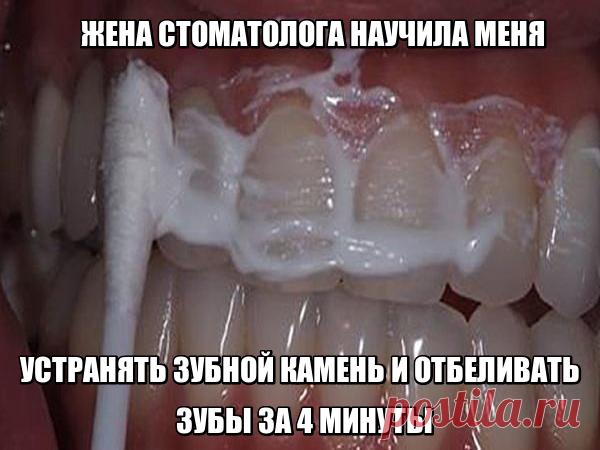 Если тебе не терпится блеснуть обезоруживающей улыбкой, но средств на стоматолога нет, то эти домашние средства для тебя. ЖЕНА СТОМАТОЛОГА НАУЧИЛА МЕНЯ УСТРАНЯТЬ ЗУБНОЙ КАМЕНЬ И ОТБЕЛИВАТЬ ЗУБЫ ЗА 4 МИНУТЫ Голливуд задал моду на белоснежную улыбку, которая считается признаком