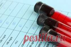 Как читать анализ крови биохимический: расшифровка показателей