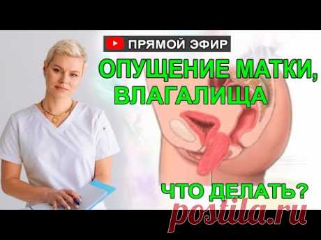 Опущение матки, и стенок влагалища что делать.  Врач Екатерина Волкова
