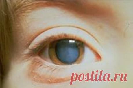 Подскажите пожалуйста у кого была катаракта. Есть опыт в ее лечении или удалении. Болею три месяца, идет ухудшение. Может что-нибудь подскажите. Очень пугает регрессия заболевания.