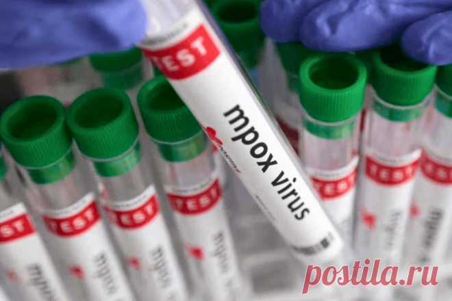 🔥 Вирусологи подчеркивают, что Mpox и COVID-19 не сопоставимы по способу распространения
👉 Читать далее по ссылке: https://lindeal.com/news/2024082701-virusologi-podcherkivayut-chto-mpox-i-covid-19-ne-sopostavimy-po-sposobu-rasprostraneniya