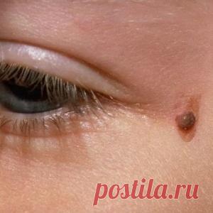 Исправляем недостатки кожи в домашних условиях