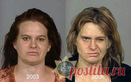 Как употребление наркотиков меняет внешность человека. Шокирующие фото До и После.
