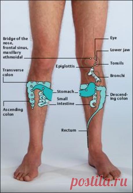 ВАРИКОЗ НОГ