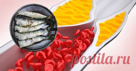 8 продуктов, которые ОЧИЩАЮТ СОСУДЫ! Избавь себя и близких от серьезной проблемы.