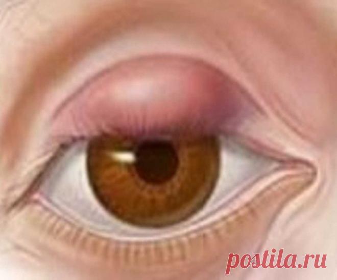 Какие есть 30 заговоров от ячменя: читать самостоятельно в домашних условиях? 100% Заговоры и заклинания