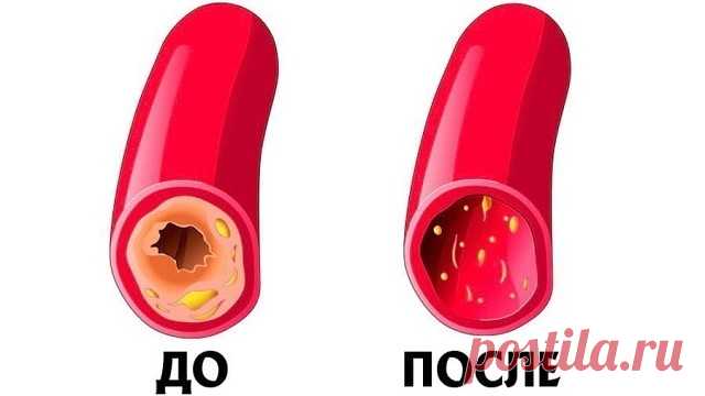 Чистим сосуды и кровь: рецепт 7 стаканов
ПОДПИШИСЬ И ЧИТАЙ ПРОДОЛЖЕНИЕ
Кардиологи ошарашены! Гипертония лечится мгновенно! Простой, бабушкин метод, нужно…