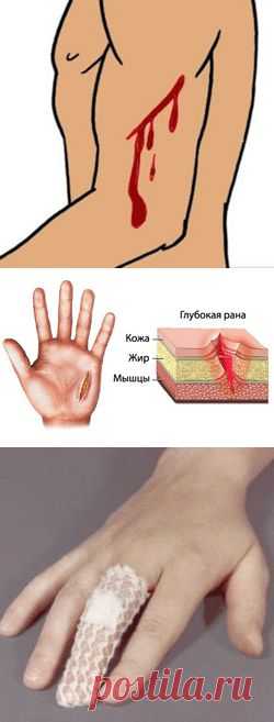 Всё о порезах