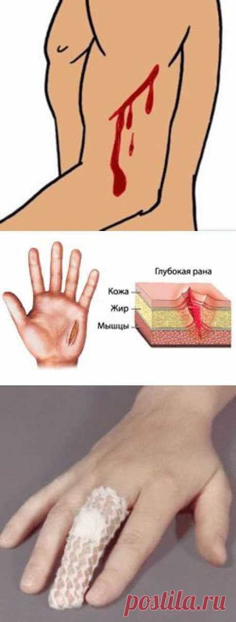 Всё о порезах