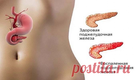 Беспокоит поджелудочная железа что делать - Сами Доктора Беспокоит поджелудочная железа что делать. Смотрите решение. По оценке некоторых специалистов есть способ не только облегчить страдания, но и навсегда забыть об этой проблеме. В этом поможет семя льна, оно единственное то, что способно вылечить вашу поджелудочную железу!