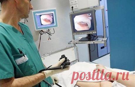 Полипы в кишечнике. Как не пропустить первые симптомы / Будьте здоровы