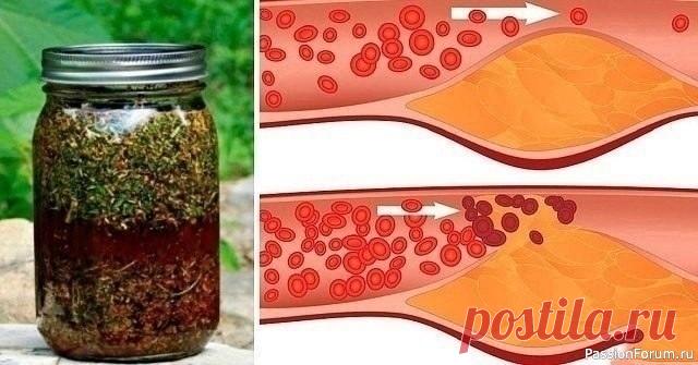 Укроп, мед, валериана для сосудов Вас беспокоят захламленные бляшками сосуды, поэтому их-то надо почистить в первую очередь. Для этого приготовить вот такой настой: 1 стакан укропного семени, 2 ст. ложки молотого корня валерианы смешать, залить 2 литрами кипятка, когда настой остынет до 40 град., добавить 2 ст. ложки...