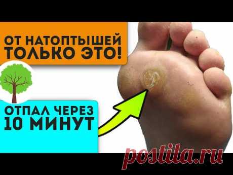 Пятки были похожи на копыта, но после смеси лимонного сока с … Кожа как у младенца!