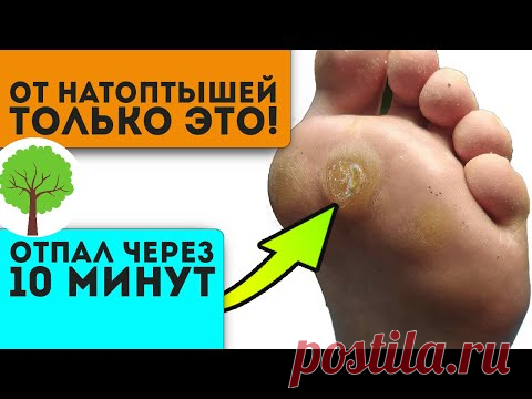 Пятки были похожи на копыта, но после смеси лимонного сока с … Кожа как у младенца!