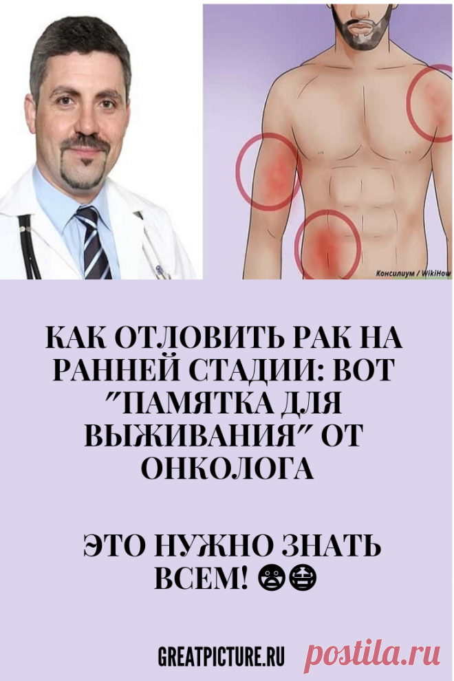 Как отловить рак на ранней стадии: Вот ″памятка для выживания″ от онколога Это нужно знать ВСЕМ! Как отловить рак на ранней стадии: Вот ″памятка для выживания″ от онколога😨😷 Методы израильской медицины.Известный израильский онколог Виктор Леви в своём блоге на сайте Сноб пишет о том, как выявить рак на ранней стадии.  #красота  #самоеинтересное  #советы #здоровье