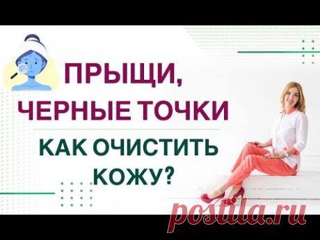 ❤️ ПРЫЩИ, ЧЕРНЫЕ ТОЧКИ… КАК ОЧИСТИТЬ КОЖУ❓ ГОРМОНЫ И КОЖА Врач эндокринолог, диетолог Ольга Павлова.