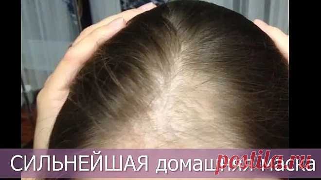 Очень сильно выпадают волосы — что делать? СИЛЬНАЯ ДОМАШНЯЯ МАСКА