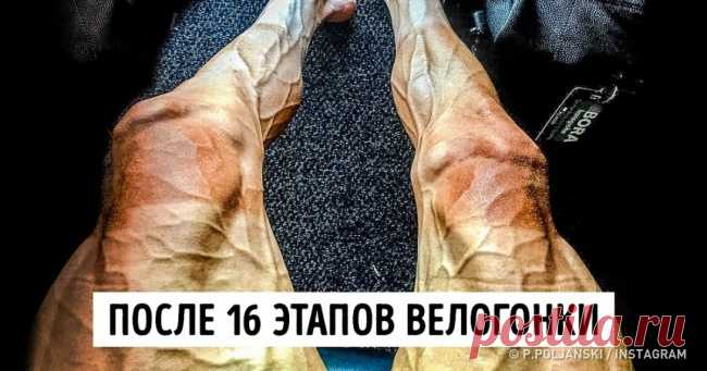 15 фото о силе человеческого духа . Милая Я
