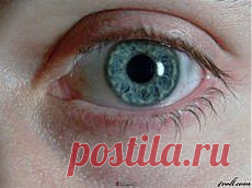 Разные причиныУ Авиценны появился очень старательный, новый ученик. Однажды к великому лекарю привели слепого. Учитель сказал ученику, какие ингредиенты нужно смешать, чтобы получилось две лепешки. Тот сделал все точь-в-точь, как было сказано. К глазам больного приложили лепешки – и на другой день тот прозрел. А сосед горе-ученика тоже был слепой. Вдохновленный таким успехом, подмастерье приготовил в точности такие же лепешки и положил ему на глаза.