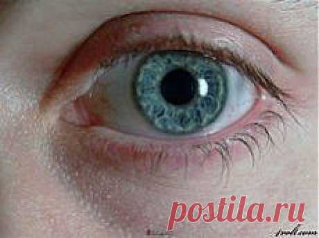 Разные причиныУ Авиценны появился очень старательный, новый ученик. Однажды к великому лекарю привели слепого. Учитель сказал ученику, какие ингредиенты нужно смешать, чтобы получилось две лепешки. Тот сделал все точь-в-точь, как было сказано. К глазам больного приложили лепешки – и на другой день тот прозрел. А сосед горе-ученика тоже был слепой. Вдохновленный таким успехом, подмастерье приготовил в точности такие же лепешки и положил ему на глаза.