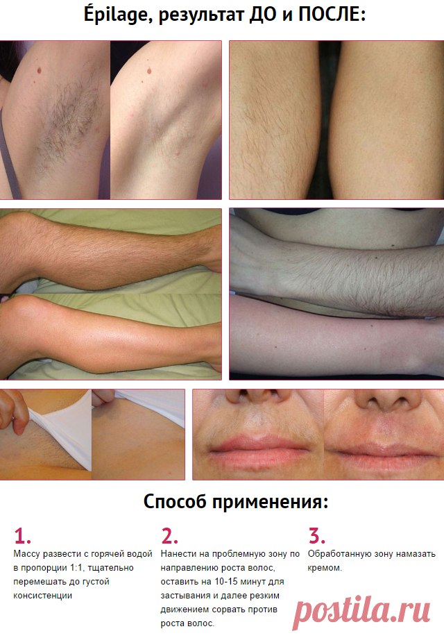 Épilage (Epilage) для депиляции - купить в Аптеке здоровья и красоты по лучшей цене в Москве и России