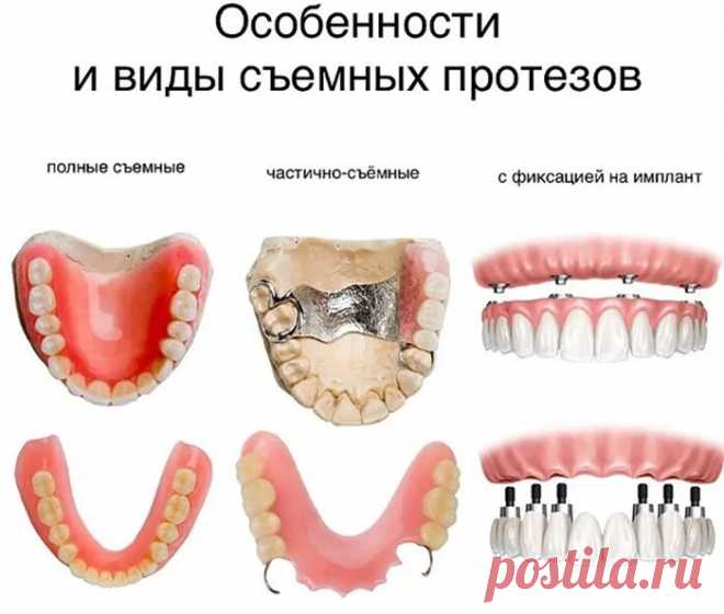 таблицы цен на съемные протезы из металлокерамики цена: 2 тыс изображений найдено в Яндекс Картинках