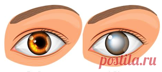 Врачи выяснили, что является одной из главных причин слепоты